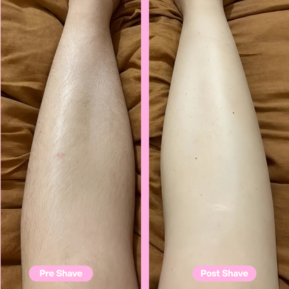 SilkDerm Pro